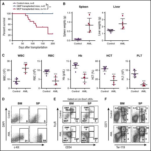 Figure 4. MEPs deficient for p53 and expressing oncogenic Nras are transformed to AML-initiating cells. Control and NrasG12D/+p53−/− mice were treated with pI-pC and euthanized on day 12 as described in “Materials and methods.” GMPs and MEPs were isolated from NrasG12D/+p53−/− bone marrow and transplanted to lethally irradiated mice as described in Table 1. Control recipients were transplanted with 2.5 × 105 total bone marrow cells (CD45.2+) from control mice and the same number of congenic bone marrow cells (CD45.1+). (A) Kaplan-Meier comparative survival analysis of recipient mice. Cumulative survival was plotted against days after transplantation. P value was determined by the log-rank test. (B) Quantification of spleen and liver weights in moribund AML mice transplanted with NrasG12D/+p53−/− MEPs and age-matched control recipients. (C) Complete blood count analysis of peripheral blood samples collected from moribund AML mice transplanted with NrasG12D/+p53−/− MEPs and age-matched control recipients. (D-F) Analysis of donor-derived (CD45.1–) (D) blast cells (c-Kit+), (E) myeloid progenitors, and (F) erythroid differentiation in BM and SP of moribund AML mice transplanted with NrasG12D/+p53−/− MEPs and age-matched control recipients. Data are presented as mean ± SD. **P < .01; ***P < .001. Hb, hemoglobin; HCT, hematocrit; PLT, platelet; RBC, red blood cell; WBC, white blood cell.