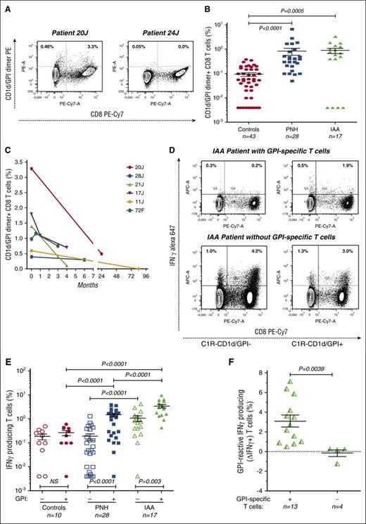 Figure 1. GPI-specific and IFN-γ-producing T cells in patients with IAA. (A) Representative FACS density plots. Monocyte-depleted peripheral blood mononuclear cells were cocultured using as APCs a C1R-CD1d/GPI-positive lymphoblastoid B-cell lines (E:T ratio 2:1). On day 6, the same number of APCs added initially were added once again. On day 7, cells were stained with mAbs against human CD3 and CD8, as well as with h-GPI-loaded CD1d dimer. The CD8+ CD1d/GPI dimer+ T cells (GPI-specific T cells) are shown here as percentage of the total T (CD3+) cells. By this technique, we are able to detect GPI-specific T cells when they are >1:25.000 CD3+ T cells. (B) Frequency of CD1d/GPI dimer+ CD8+ T cells (GPI-specific T cells) from healthy control patients, patients with PNH, and patients with IAA tested at the time of diagnosis. On the ordinate, T cells counted as percentage of CD3+ T cells. P values by Mann Whitney test are shown. (C) Frequency of GPI-specific T cells measured on sequential samples taken at diagnosis and at different times (1-84 months) from the start of immunosuppressive treatment. In these 6 patients, the average frequency decreased significantly from 1.4 ± 1% at diagnosis to 0.4 ± 0.3% at the last follow-up point (P = .03, Wilcoxon signed rank test). (D) Representative FACS density plots. Monocyte-depleted peripheral blood mononuclear cells were cocultured, using as APCs the C1R-CD1d/GPI-negative (right) as well as the C1R-CD1d/GPI-positive (left) lymphoblastoid B-cell lines (E:T ratio, 2:1). On day 6, the same number of APCs added initially were added once again. On day 7, cells were stained with mAbs against human CD3 and CD8, as well as intracellular IFN-γ. The IFN-γ+Cd8+ T cells (IFN-γ-producing T cells) are shown here as percentage of the total T (CD3+) cells. By this technique, we are able to detect IFN-γ-producing T cells when they are >1:25.000 CD3+ T cells. (E) Frequency of IFN-γ+CD8+ T cells (IFN-γ-producing T cells) obtained after coculture with C1R-CD1d/GPI-negative APC (empty symbols) or C1R-CD1d/GPI-positive APC (full symbols) from 43 healthy control patients, 28 patients with PNH, and 17 patients with IAA studied at the time of diagnosis. On the ordinate, IFN-γ-producing T cells are shown as percentage of the total T (CD3+) cells. P values by Mann-Whitney test are shown. (F) The frequency of T cells that specifically produce IFN-γ in response to GPI (GPI-reactive IFN-γ-producing T cells) has been calculated as difference (∆IFN-γ+ T cells) between the frequency of IFN-γ-producing T cells after culture on GPI-positive APC and the frequency of IFN-γ-producing T cells after culture on GPI-negative APC. Here GPI-reactive IFN-γ-producing T cells (∆IFNγ+ T cells) are shown separately for the 13 patients with IAA who had detectable GPI-specific T cells and for the 4 patients with IAA who did not have detectable GPI-specific T cells. P values by Mann Whitney test are shown.