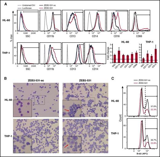 Figure 5. ZEB2 suppression induces aberrant differentiation of human AML cells. (A) (Left) Flow cytometric analysis of side-scatter profiles and the expression of CD11b, CD13, CD14, CD16, and CD16 in HL-60 and THP-1 cells infected with ZEB2-531 and its seed control (ZEB2-531-sc) at day 6. (Right) Quantification of results from the left shown as average fold change of marker expression comparing ZEB2 shRNA (ZEB2-531) and seed control (ZEB2-531-sc). Error bars, SD (n = 3). (B) Representative May-Grunwald-Giemsa staining of HL-60 and THP-1 cells at day 10 after infection. Original magnification ×200; original magnification for insets ×400. (C) Flow cytometric analysis of BrdU incorporation in HL-60 and THP-1 cells at day 6 after infection.