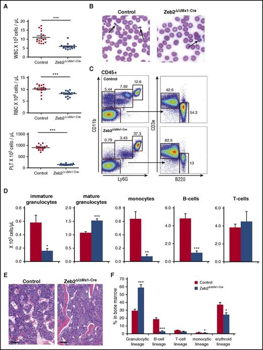 Figure 1. Zeb2 deletion causes cytopenia in multiple hematopoietic lineages. (A) Absolute numbers of mature blood cells in mice at 8 weeks after Poly(I:C) administration significantly reduces leukocytes, erythrocytes, and thrombocytes in Zeb2Δ/ΔMx1-Cre mice. PLT, platelet; RBC, red blood cell; WBC, white blood cell. (B) Representative images of peripheral blood smears from control and Zeb2Δ/ΔMx1-Cre mice. Smears demonstrate absence of regular thrombocytes but sporadic giant platelets in absence of Zeb2 (arrows). (C) Representative FACS plots and gating strategy of peripheral blood analyses at 8 weeks after Poly(I:C) administration to define monocyte (Ly6G−CD11b+) frequency, immature and mature granulocytes (Ly6GdimCD11b+ and Ly6GhighCD11b+, respectively), B lymphocytes (B220+), and T lymphocytes (CD3e+). (D) Quantified absolute cell numbers of the leukocyte subsets per microliter of blood of control and Zeb2Δ/ΔMx1-Cre mice revealed significant reduction in B cells, monocytes, and immature granulocytes, but comparable counts of mature granulocytes and T cells. (E) Histologic examination of Zeb2Δ/ΔMx1-Cre and control femurs shows comparable BM cellularity. Bar graphs represent 100 µm. (F) Analyses of BM composition of different hematopoietic lineages show a predominant occurrence of granulopoiesis with a relative decrease of all other lineages. Data are from 4 independent Zeb2 inactivation experiments using in total 12 mice (A and D), and 3 experiments with 6 mice per genotype (F). Mean ± SEM is shown. Unpaired, 2-tailed t test was performed to determine significance *P < .05, **P < .01; ***P < .001.