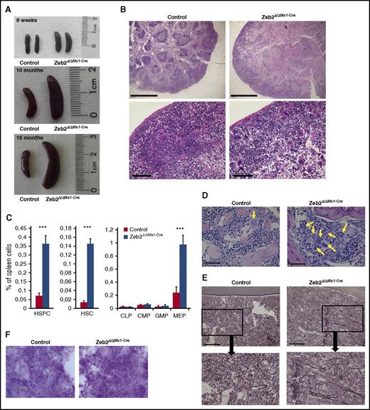Figure 5. Zeb2Δ/ΔMx1-Cre mice show characteristic features of myeloproliferative disease. (A) Representative images of spleens from Zeb2Δ/ΔMx1-Cre and control mice at 8 weeks, 10 months, and 16 months after Poly(I:C) administration demonstrating progressive splenomegaly in Zeb2-deficient mice. Data are representative of at least 3 independent experiments. (B) Histological analyses of spleen sections show extensive loss of white pulp compartment in Zeb2-deficient mice. Data are representative of at least 3 independent experiments. Bar graphs, 1000 µm (top); 100 µm (bottom). (C) A significant increase in the appearance of LKS, LKS-SLAM, and MEP populations within the spleen of Zeb2Δ/ΔMx1-Cre mice compared with controls indicate a relocation of hematopoiesis to the spleen. Data are from 6 biological replicates shown as means ± SEM. Unpaired, 2-tailed t test was performed to determine significance; ***P < .01. (D) Hematoxylin and eosin staining of BM sections demonstrate grouping of abnormal megakaryocytes (arrows) in Zeb2Δ/ΔMx1-Cre mice. Bar graphs, 50 µm. (E) Silver staining shows the presence of reticular fibers in the BM space in Zeb2Δ/ΔMx1-Cre mice. Bar graphs, 100 µm. (F) BM smears were subjected to Prussian Blue staining for hemosiderin demonstrating iron depletion in Zeb2Δ/ΔMx1-Cre marrow cells.