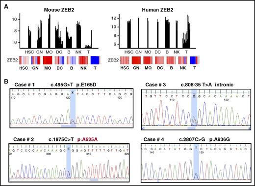 Figure 7. Zeb2 mutation in human hematopoietic malignancies. (A) Comparison of Zeb2 expression between murine and human hematopoietic cell subsets based on the Immgen database. (B) Sequencing analyses of Zeb2 allele revealed point mutations in 4 of 237 cases.