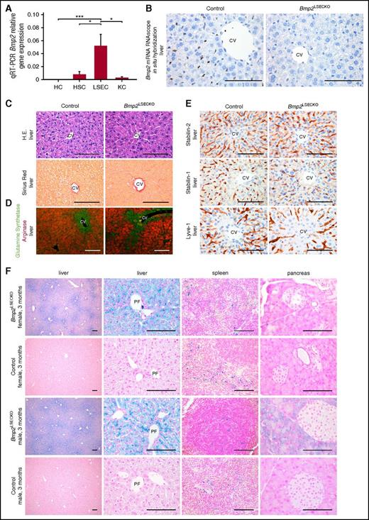 Figure 1. Angiocrine Bmp2 signaling in the liver controls tissue iron content and distribution. (A) Comparative qRT-PCR analysis of Bmp2 mRNA expression in LSECs, hepatocytes (HC), Kupffer cells (KC), and stellate cells (HSC) isolated from livers of wild-type (WT) adult C57Bl/6 mice (n = 5). β-2-Microglobulin was used as housekeeping gene. *P < .05; ***P < .001. (B) Bmp2 mRNA in situ hybridization of liver sections of Bmp2LSECKO mice in comparison with WT controls (n = 3). Scale bar, 100 μm (×60). CV, central vein. (C) Hematoxylin and eosin (H.E.) and Sirius red staining of liver sections of Bmp2LSECKO mice in comparison with WT controls (n = 6). Scale bar, 100 μm (×60). (D) Coimmunofluorescence of GS and arginase in liver (n = 5). Scale bar, 100 μm (×20). (E) Immunohistochemistry of LSEC markers in livers of Bmp2LSECKO and control mice (n = 5). Scale bar, 100 μm (×60). (F) Prussian blue staining demonstrating iron deposition in liver, spleen, and pancreas of Bmp2LSECKO (female, n = 5; male, n = 5). Scale bar, 100 μm (first column, ×10; third column, ×40; second and fourth columns, ×60). PF, portal field.