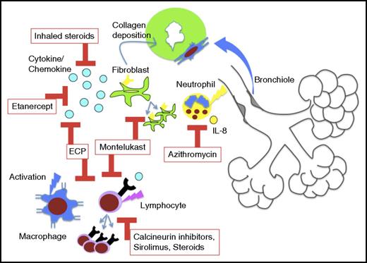 Figure 4. Diagram of the proposed immune mechanisms linked to BOS pathogenesis, the current treatments in BOS, and the pathways blocked by these treatments. Cytokine/chemokine indicates TNF α for etanercept and multiple activating chemokines and cytokines for ECP.
