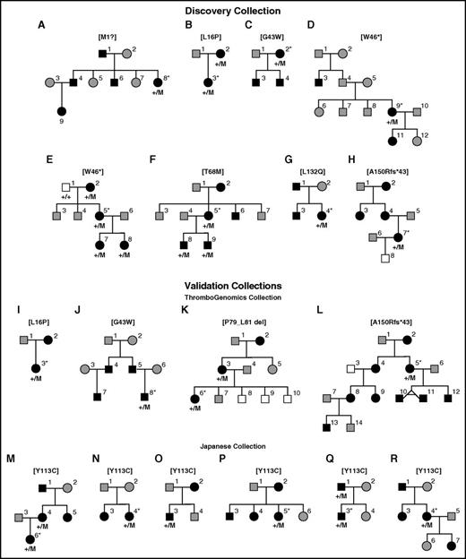 Figure 1. Graphic representation of the 18 pedigrees with autosomal dominant inheritance of macrothrombocytopenia in the discovery and validation collections. No genome-wide excess relatedness among individuals subjected to high-throughput sequencing from different pedigrees sharing the same variant (pedigrees B and I, C and J, D and E, and H and L) could be detected by genetic analysis,25 although the shared variants in GP1BB may have been co-inherited from a distant common ancestor. Filled symbols, macrothrombocytopenia; gray symbols, unknown; blank symbols, normal platelet count and volume and absence of macrothrombocytes. Squares, males; circles, females; +/M, heterozygous; +/+: wild-type. A second variant encoding L175P was identified by Sanger sequencing in K-3 absent from K-6, which might influence PLT and MPV by affecting the cytoskeleton. The probability of the genotyping results under the null hypothesis of random segregation, conditional on the genotypes of the index cases, is 0.59 = 1.95 × 10−3.