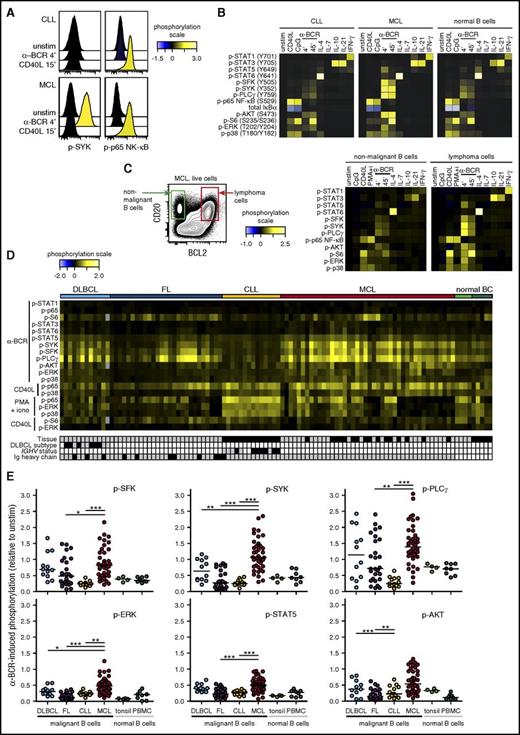 Figure 2. Activation-induced signaling reveals contrasting differences between NHL subtypes, and potentiated α-BCR–induced signaling in MCL. Patient samples and control samples were thawed and rested for 20 minutes before activation with CD40L, IL-4, IL-7, IL-10, IL-21, or IFN-γ for 15 minutes, CpG for 45 minutes, BCR engagement with F(ab′)2 anti-IgM and anti-IgG (α-BCR) for 4 minutes or 45 minutes, or left untreated (unstim) (see supplemental Figure 1). Tumor cells were identified as described in Figure 1. (A) Histogram overlays of α-BCR– or CD40L-induced p-SYK and p-p65 NF-κB in CLL and MCL cells, shown relative to unstimulated cells. (B) Typical activation-induced signaling profiles shown as heatmaps of lymphoma cells from CLL and MCL patient samples as compared with healthy donor PBMC B cells. (C) Gating on lymphoma cells (CD20+BCL2+CD5+CD3−) and nonmalignant B cells (CD20+BCL2−CD5−CD3−) within the same patient sample revealed potentiated signaling in malignant B cells. (D) Heatmap of major activation-induced phosphorylation levels in lymphoma cells, across different types of NHLs. Each column represents a patient sample, and the rows were clustered for visual clarity (dendrogram not shown). Samples were annotated for tissue (gray, LN; black, peripheral blood), DLBCL subtype (gray, GCB; black, non-GCB; white, n.d.), IGHV status (gray, unmutated; black, mutated; white, n.d.), and Ig heavy chain (gray, IgM; black, IgG). (E) Scatter plots of α-BCR–induced phosphorylation levels in lymphoma cells, relative to unstimulated cells. Each dot represents a single patient sample. Phosphorylation levels are relative to unstimulated lymphoma cells from the same patient. DLBCL (n = 12), FL (n = 27), CLL (n = 14), MCL (n = 42). Healthy donor controls: tonsillar B cells (n = 4) and PBMC B cells (n = 8). Statistical difference was calculated using the Mann-Whitney nonparametric test (***P < .0001, **P < .005, *P < .05). iono, ionomycin.
