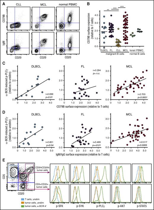 Figure 3. α-BCR–induced signaling in MCL cells is associated with increased surface expression of BCR subunits CD79B and IgM. (A) Contour plots of CD20 expression vs CD79B or IgM expression in CLL, MCL, and healthy donor PBMC sample, respectively. (B) Expression of CD79B in lymphoma cells relative to T cells present in same sample in DLBCL, FL, CLL, MCL, and healthy donor tonsil and PBMC samples. (C) Association between α-BCR–induced p-PLCγ and CD79B surface expression in DLBCL, FL, and MCL. Each dot represents a patient sample. (D) Association between α-BCR–induced p-PLCγ and tumor heavy-chain expression (IgG or IgM for DLBCL, FL, and IgM for MCL). (E) The presence of 2 distinct lymphoma subclones in a MCL patient (MCL-R001), based on expression of CD5 and CD20, demonstrates potentiated α-BCR–induced phosphorylation events in the CD5hiCD20hi subclone. The CD20hiCD5hi cells are CD79Bhi, as compared with CD20+CD5+ lymphoma cells (see supplemental Figure 9E). DLBCL (n = 12), FL (n = 27), CLL (n = 14), MCL (n = 42). Healthy donor controls: tonsillar B cells (n = 4) and PBMC B cells (n = 5). Note that surface protein expression of CD79B and IgM were obtained as separate immunophenotypic staining, and not included in the signaling assay. Statistical difference was calculated using the Mann-Whitney nonparametric test (***P < .0001, **P < .005), and correlation was calculated by the Spearman rank test.