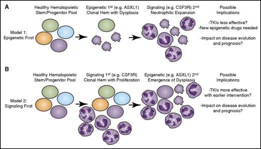Figure 4. Longitudinal acquisition of mutations may have an impact on disease course and therapeutic strategies. Recent genomic findings in CNL and aCML have indicated that mutations may arise in at least 3 different categories of genes: epigenetic modifiers, components of the spliceosome, and growth factor signaling pathways. It is likely that these mutations are acquired through a process of age-related clonal hematopoiesis (Hem) in which 1 of these mutational events initiates (A) a dysplastic or (B) a proliferative anomaly with subsequent acquisition of the other gene categories resulting in evolution to overt disease. The identity of the gene that initiates this process may have important implications for the manner in which the disease proceeds down distinct diagnostic trajectories as well as the possibility for success of targeted therapies such as tyrosine kinase inhibitors (TKIs) as well as emerging agents that target epigenetic or splicing processes.
