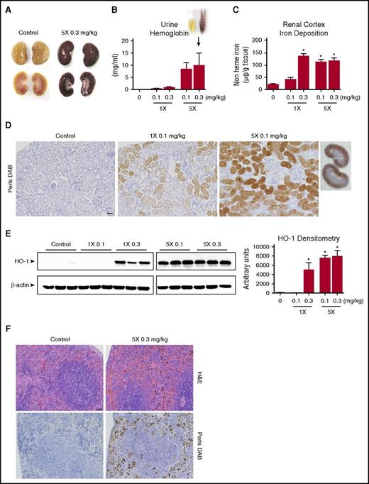 Figure 3. Tissue iron deposition secondary to PEO+ induced hemolysis. (A) High levels of cell free hemoglobin result in macroscopic discoloration of kidneys after exposure to IV PEO+. (B) Quantitation of T24h urine hemoglobin. (C) Quantitation of nonheme bound iron accumulation in the renal cortex of PEO+ injected animals measured by a colorimetric ferrozine-based assay at the study end point. (D) Iron deposition within the renal cortex highlighted by Perls DAB staining. Renal cortical areas are shown from control, single (1×), and multidosed (5×) animals (scale bar, 50 µm), demonstrating the tendency for iron to deposit within the proximal tubule. (E) Western blot of HO-1 expression in kidney tissue and its quantitative densitometric analysis. β-actin was probed as a loading control. (F) Splenic sections stained with H&E and Perls DAB from a multidosed (5×) and control animal (scale bar, 50 µm), demonstrating increased hemosiderin deposition and red cell engorgement. Data displayed as mean values ± SEM (n = 4 per group). *P < .05 (1-way ANOVA).