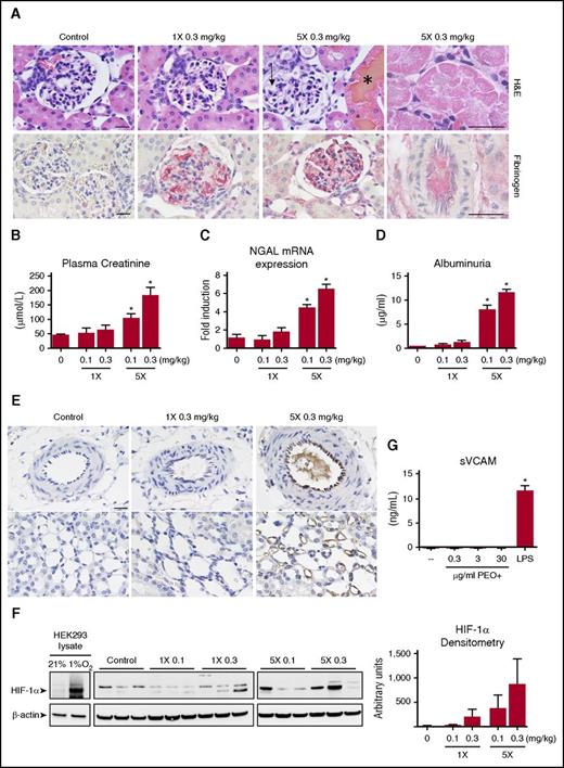Figure 4. PEO+ induced acute kidney injury and identification of HWM PEO in the microvasculature. (A) Representative kidney sections stained with H&E (top panel) and for fibrinogen by immunohistochemistry (NovaRed, bottom panel) (scale bar, 20 µm). Multidosed (5×) animals demonstrate glomerular capillary swelling (arrow), patchy necrosis of proximal tubule cells with widespread eosinophilic intracellular inclusions (rightmost panel), and hemoglobin laden tubular casts (*). A dose-dependent increase in fibrin deposition within the glomerular capillaries of PEO+ treated animals could be found. (B-D) Quantitation of T24h plasma creatinine levels, renal cortex mRNA NGAL levels, and urinary albumin after PEO+ administration (n = 4 per group). (E) Kidney sections of control, single (1×) and multidosed (5×) PEO+ animals were immunohistochemically stained for PEO using a monoclonal antibody against the polyethylene backbone with DAB development. Interlobular arteries (top panel) and vasa recta lining the loop of Henle (bottom panel) are shown (scale bar, 20 µm). (F) Western blot for HIF-1α expression in the renal cortex of representative animals. β-actin was probed as a protein loading control. Cell lysates of hypoxic (8 hours at 1% O2) and normoxic (21% O2) HEK293 cells served as a reference of the HIF-1α–specific upregulated band. (G) HUVECs were cultured for 24 hours in the presence of various concentrations of PEO+ or activated with 1 µg/mL lipopolysaccharide. The amount of sVCAM released into the cell culture supernatant was quantified by ELISA. *P < .05 (1-way ANOVA).