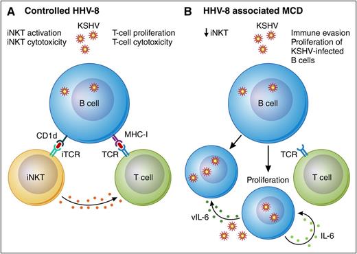 Model of HHV-8–associated MCD associated with diminished iNKT cells. (A) Controlled HHV-8 infection of B cells is associated with limited lytic activation of HHV-8 and effective immune surveillance by T cells and iNKT cells. Activated iNKT cells likely produce cytokines that further promote antiviral immunity in this setting. (B) HHV-8–associated MCD is associated with decreased iNKT cells. In addition, dysregulated lytic activation of HHV-8 leads to upregulation of the HHV-8–encoded E3 ubiquitin ligases K3 and K5, which downregulate CD1d and MHC-I and further promote immune evasion. Upregulation of human and viral IL-6 and other cytokines in this setting promotes proliferation of HHV-8–infected B cells. iTCR, invariant T-cell receptor; TCR, T-cell receptor; vIL-6, viral IL-6. Professional illustration by Patrick Lane, ScEYEnce Studios.
