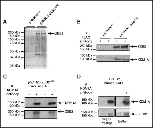 Figure 1. ZEB2 interacts with KDM1A in T-ALL cell lines. (A) Silver stain of SDS–polyacrylamide gel electrophoresis after pull downs of FLAG-ZEB2 protein complex. (B) Coimmunoprecipitation of KDM1A after pull down of FLAG-ZEB2 protein complex in mouse T-ALL cell lines. (C) Coimmunoprecipitation of ZEB2 after pull down of KDM1A protein complex in mouse T-ALL cell lines. (D) Coimmunoprecipitation of ZEB2 after pull down of KDM1A protein complex in the human T-ALL cell line LOUCY, using 2 antibodies that recognize human ZEB2.