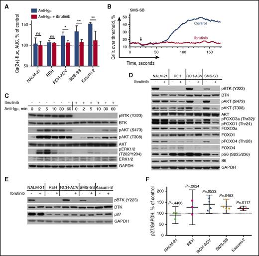 Figure 2. Ibrutinib thwarts pre-BCR signaling in B-ALL. (A) Ca2+ mobilization in B-ALL cells after pre-BCR cross-linking with anti-Igµ. ALL cells were pretreated with 1 µM of ibrutinib or without. The background fluorescence threshold was established at the fluorescence intensity of 85th percentile of unstimulated cells. Area under the curve was calculated and normalized to a background reading of a particular sample and then to the response of control cells. Displayed are the means with 95% CI from 3–6 independent experiments. (B) Representative display of Ca2+ mobilization in pre-BCR+ B-ALL cells after anti-Igµ stimulation (indicated by the arrow), with or without ibrutinib pretreatment. (C) Western blot showing that ibrutinib treatment effectively abrogates anti-Igµ-induced pre-BCR-dependent BTK, Akt, and ERK activation in RCH-ACV cells. (D) Western blot showing that treatment with 0.5 µM of ibrutinib for 1 hour suppresses baseline Akt signaling in pre-BCR+ (RCH-ACV, SMS-SB) but not in pre-BCR− (NALM-21, REH) B-ALL. (E-F) Western blot analysis of p27 content in ALL cells exposed to ibrutinib for 24 hours (E) and densitometry of 3–4 independent experiments presented as the mean with 95% CI (F). AUC, area under the curve. ns, not significant. *P < .05; **P < .01.