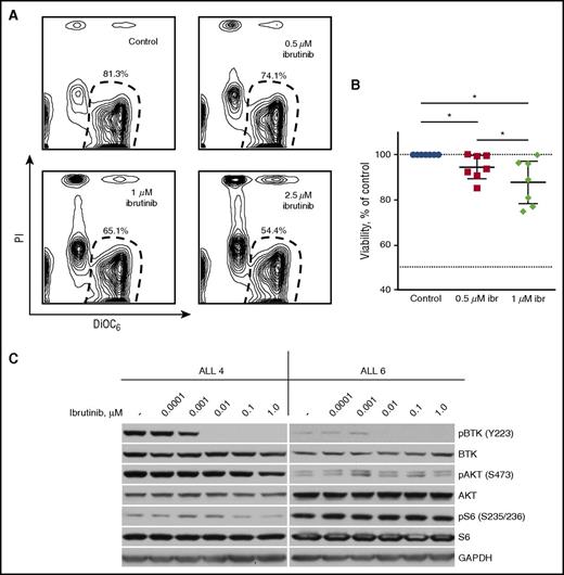 Figure 5. Ibrutinib induces apoptosis of primary ALL cells. (A) Primary ALL cells cocultured with KUSA-H1 stromal cells were treated with ibrutinib (ibr) for 48 hours. Representative counter plots show a fraction of viable ALL cells as determined by DiOC6/PI staining and flow cytometry. (B) Ibrutinib significantly reduced viability of primary ALL cells after 48 hours of treatment. Percentage of viable ALL cells was normalized to DMSO-treated control. Displayed are the mean with 95% CI of 7 ALL samples. (C) Ibrutinib inhibits Akt in sensitive ALL cells (ALL 4) but not in insensitive cells (ALL 6), as determined by western blotting. *P < .05.