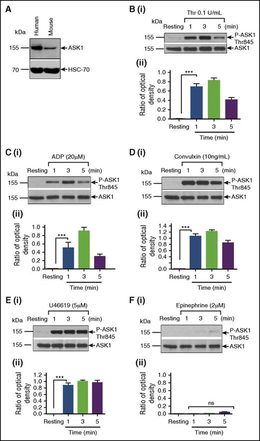 Figure 1. Platelet agonists induce ASK1 phosphorylation. (A) Western blot analysis of lysates from human and murine platelet (free from WBCs) blotted with anti-ASK1 (Cell Signaling; upper panel); reprobed with anti-HSC-70 to ensure equal loading (lower panel). (B-F) Washed human platelets (4 × 108) were stimulated with or without (resting) agonist at different time points, as indicated. Lysates were Western blotted using phosphospecific anti-T845ASK1, which recognizes both human and murine phospho-ASK1. The same blot was reprobed with anti-ASK1 to ensure equal protein loading in all the lanes. Western blot of lysates from resting and thrombin-stimulated platelets (Bi) and the quantitation of band intensity (Bii). Western blot of lysates from resting and ADP stimulated platelets (Ci) and the quantitation of band intensity(Cii). Western blot of lysates from resting and convulxin-stimulated platelets (Di) and the quantitation of band intensity (Dii). Western blot of lysates resting and U46619 stimulated platelet (Ei) and the quantitation of band intensity (Eii). Western blot of lysates from resting and epinephrine-stimulated platelets (Fi) and the quantitation of band intensity (Fii). Band density was calculated by using National Institutes of Health Image J software. All the experiments were repeated more than 3 times using platelets from different individual donors. ns, not significant; Thr, thrombin. ***P < .001.