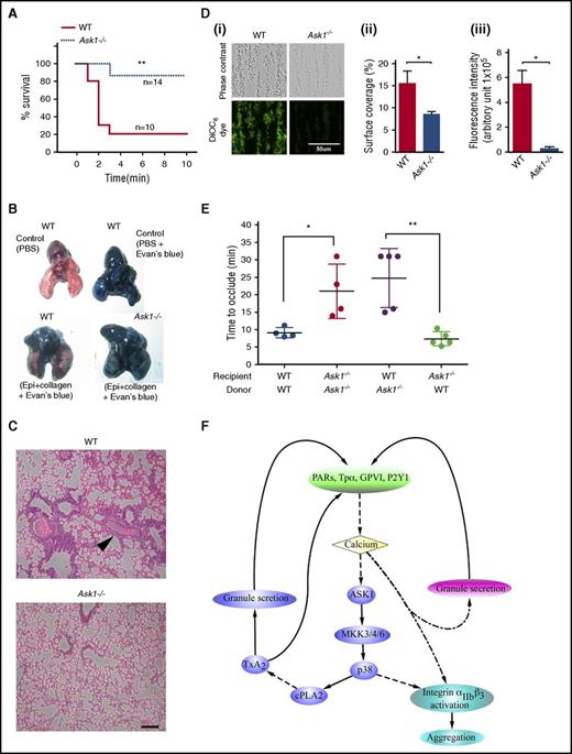 Figure 7. Deletion of Ask1 protects mice from pulmonary thromboembolism. (A) Survival curve of WT (n = 10) and Ask1−/− (n = 15) mice after tail vein injection of a mixture of collagen (0.4 mg/kg) and epinephrine (60 mg/kg; Sigma) in 100 μL of PBS. Time of cessation of respiration (time needed to the onset of respiratory arrest that lasted at least 2-3 minutes) was recorded. (B) Pictures of mouse lungs from panel A, injected with 0.5 mL of Evans blue solution (1% in saline) into the heart 2 minutes after the onset of respiratory arrest, but while the heart was still beating or at the completion of the 10-minute observation period. Lungs were excised and photographed with a Nikon Coolpix camera. (C) Photographs of hematoxylin and eosin (H&E)–stained paraffin embedded sections of lung from panel B. Scale bar, 10 μm. (Di) Representative images of microfluidic chambers through which anticoagulated (heparin/PPACK) blood from WT and Ask1−/− mice labeled with DiOC6 was passed over on immobilized collagen (shear rate 800 s−1) for 3 minutes. Representative images were taken under ×20 magnification with an EVOS microscope; phase contrast (upper panel) and DiOC6 (green stained; lower panel). Percentage of surface area coverage (Dii) and fluorescence intensity (Diii) were analyzed with Image J (National Institutes of Health). Scale bar, 50 μm. (E) Quantitation of carotid occlusion time after FeCl3 injury in platelet-depleted recipient mice receiving platelets from indicated donor mice. (F) Schematic representation of the Ask1-dependent MAPK pathway that is activated downstream of agonist receptors and partly responsible for granular secretion and integrin αIIbβ3 activation. Epi, epinephrine; PARs, protease-activated receptors. *P < .05; **P < .01.