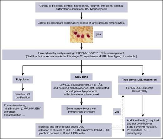 Figure 3. Algorithm of the diagnosis of LGL leukemia. EBV, Epstein-Barr virus.