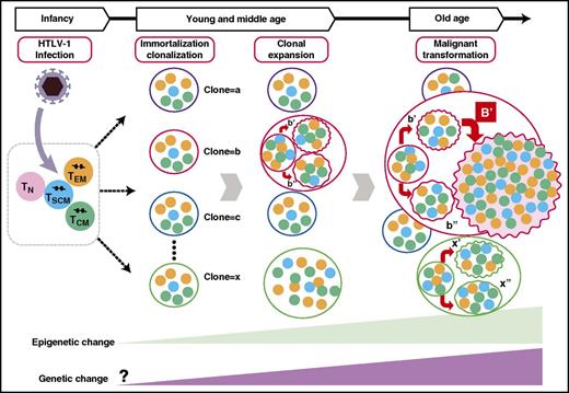 Figure 6. Schematic presentation of the clonal progression and hierarchical structure of HTLV-1–infected T cells. A clone that is defined by the integration site contains subclones with different genetic abnormalities. Among these subclones, there is a hierarchical structure where TSCM cells behave as ATL-initiating stem cells. TCM, CD45RO+ central memory T cells; TEM, CD45RO+ effector memory T cells; TN, CD45RA+ naive T cells.