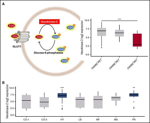 Figure 2. HK2 expression. (A) A schema illustrating the functional role of HK2 in the metabolism of FDG (left panel) and a boxplot with the expression level of HK2 in PCs obtained from patients with DWIBS+PET+, DWIBS−PET−, and DWIBS+PET− imaging results (right panel). (B) The plot shows HK2 expression in PCs stratified by UAMS molecular subgroups.11