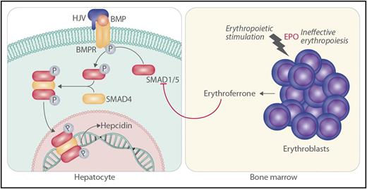 The work of Wang et al is consistent with the following scenario. In the hepatocyte, SMAD1 and SMAD5 cooperate to mediate iron-related signaling through hemojuvelin (HJV), BMP, and BMP receptor (BMPR) for the promotion of hepcidin transcription through phosphorylated SMAD4. Homozygous inactivation of HJV or other molecules in the hepcidin-activation pathway leads to hemochromatosis through decreased SMAD1 and SMAD5 signaling and lack of hepcidin. Stimulation of erythroblasts by erythropoietin (EPO), especially in the setting of ineffective erythropoiesis, leads to increased production of erythroferrone by erythroblasts. In turn, erythroferrone serves to decrease phosphorylation (P) of SMAD1 and SMAD5 in hepatocytes, leading to iron loading as a result of lack of hepcidin.