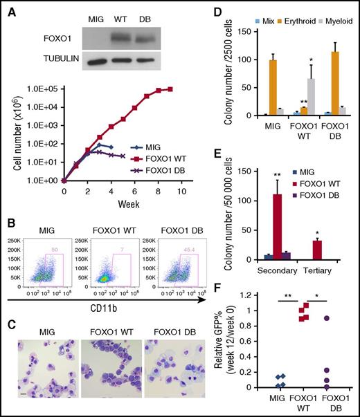 Figure 4. Increased FOXO1 promotes a preleukemic state in human CD34+ HSPCs . (A) Weekly cell count of liquid culture of CD34+ HSPCs transduced with FOXO1 WT, DB, or control (MIG) retroviral vectors. FOXO1 expression was confirmed by immunoblot. One representative experiment of 3 replicates is shown. (B) Flow cytometry analysis of the myeloid differentiation marker CD11b on cells from a week-4 culture. (C) Wright-Giemsa staining of week-4 cultured cells. The images were obtained using Motic BA310 microscope with ×40 objective. Bar represents 20 μm. (D and E) CFU assay with transduced cells. Results represent mean ± SD of colony counts of first round (D; *P < .05, **P < .001) and second and third rounds (E; *P < .01, **P < .005); n = 3. (F) Transduced cells were transplanted into immunodeficient mice. GFP+ percentage of human engrafted cells in bone marrow was examined 12 weeks later and normalized to those before the transplantation. *P < .05; **P < 1 × 10−5. One representative experiment of 2 replicates is shown. All P values were calculated by unpaired 2-tailed Student t test.