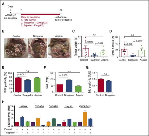 Figure 1. Ticagrelor reduces the growth of tumors in murine models of ovarian cancer. (A) Therapeutic schema for treatment with antiplatelet agents. (B) Representative images of tumors from each treatment groups. (C) Mean aggregate tumor weight. (D) Number of tumor nodules induced by intraperitoneal injection of A2780ip2 human ovarian cancer cells into nude mice treated with antiplatelet agents (n = 10 mice per group). (E) Quantification of Ki67-positive cells in resected tumors (n = 15 HPFs/5 mice per group). (F) CC3 quantification in control mice (red bars), mice treated with ticagrelor (blue bars), and mice treated with aspirin (green bars) (n = 15 HPFs/5 mice per group). (G) Effect of ticagrelor on the in vitro proliferation rate of A2780ip2 human ovarian cancer cells in the absence of platelets. (H) The effect of ticagrelor on the in vitro proliferation rate of A2780ip2, OVCAR8, OVCAR5, HeyA8, and OVCAR432 ovarian cancer cells in the absence and presence of platelets. Results are normalized to the proliferation rate of A2780ip2, OVCAR8, OVCAR5, HeyA8, and OVCAR432 in the absence of platelets and ticagrelor (n = 3 triplicate experiments).