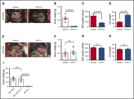 Figure 2. P2Y12 on platelets plays an important role in the growth of ovarian cancer. (A) Representative images of a necropsy on WT and P2Y12−/− tumor-bearing mice that carried tumors induced by intraperitoneal injection of ID8-VEGF murine ovarian cancer cells. (B) Mean aggregate tumor weight in WT and P2Y12−/− tumor-bearing mice (n = 10 mice per group). (C) Proliferation rate as quantified by the percentage of Ki67-positive cells in tumors resected from WT and P2Y12−/− tumor-bearing mice (n = 15 HPFs/5 mice per group). (D) Apoptosis rate as quantified by CC3 positivity in tumors from WT and P2Y12−/− mice (n = 15 HPFs/5 mice per group). (E) Representative images of a necropsy on WT and P2Y1−/− tumor-bearing mice that carried tumors induced by intraperitoneal injection of ID8-VEGF murine ovarian cancer cells. (F) Mean aggregate tumor weight in WT and P2Y1−/− tumor-bearing mice (n = 10 mice per group). (G) Proliferation rate as quantified by the percentage of Ki67-positive cells in tumors resected from WT and P2Y1−/− tumor-bearing mice (n = 15 HPFs/5 mice per group). (H) Apoptosis rate as quantified by CC3 positivity in tumors from WT and P2Y1−/− mice (n = 15 HPFs/5 mice per group). (I) Mean aggregate tumor weight after adoptive transfer of WT hematopoietic progenitor cells to lethally irradiated P2Y12−/− and WT recipient mice (WT→P2Y12−/− and WT→WT, respectively). Nontransplanted P2Y12−/− mice served as a negative control (n = 5 mice per group, P = .0019).