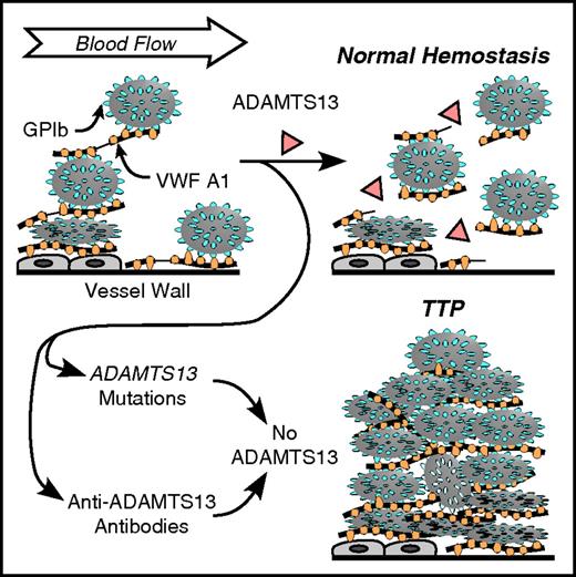 Figure 2. Role of VWF and ADAMTS13 in platelet adhesion. VWF multimers may adhere to endothelial cells or to connective tissue in the vessel wall. Platelet GPIb binds to the VWF A1 domain. Flowing blood applies force to the platelets that stretches VWF and exposes a cleavage site for ADAMTS13 in the A2 domain (thin lines in VWF multimers attacked by ADAMTS13). Cleavage of VWF limits the growth of intravascular thrombi. Congenital or acquired ADAMTS13 deficiency allows excessive platelet deposition, causing microvascular thrombosis and TTP.