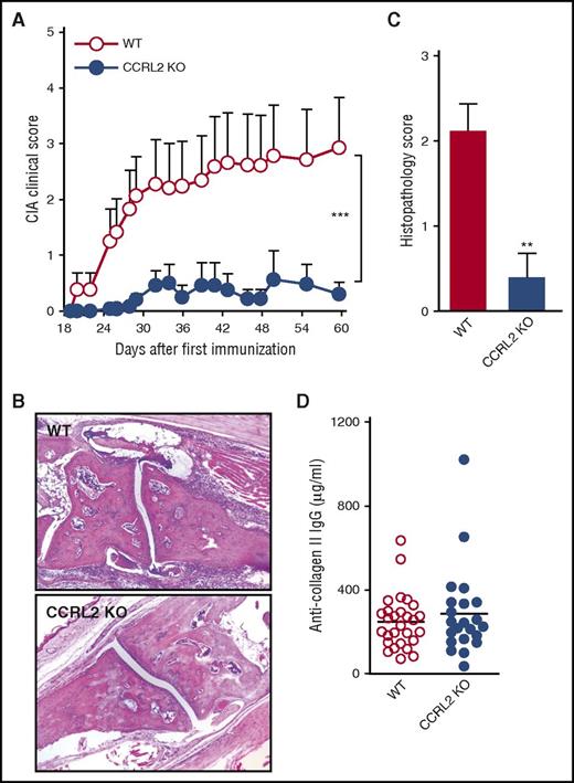 Figure 2. CCRL2-deficient mice are protected in CIA. (A) Clinical score of CIA in WT and CCRL2-deficient (KO) mice immunized with chicken type II collagen. Scores from 4 paws were combined for each mouse, and total severity score for the group was divided by the number of arthritic mice to obtain an average severity score (clinical score, 0-16 in the 4 paws). Data are shown as mean ± SEM from 1 representative experiment of 3 (WT, n = 29; CCRL2 KO, n = 24). (B) Histopathology of a representative arthritic joint from WT and CCRL2 KO mice (original magnification 4×). (C) Histopathologic score of arthritic mice as evaluated for leukocyte infiltration, erosion, pannus, necrosis/fibrosis, loss of cartilage, and bone integrity. Data are shown as mean ± SEM of arthritic scores of 1 representative experiment (WT, n = 8; CCRL2 KO, n = 10). (D) Levels of total anti-collagen II immunoglobulin G (IgG) (μg/mL) measured in mouse sera at the end of the experiment (day +60). **P < .01 by Mann-Whitney U test; ***P < .001 for WT vs CCRL2 KO mice by two-way analysis of variance (ANOVA).