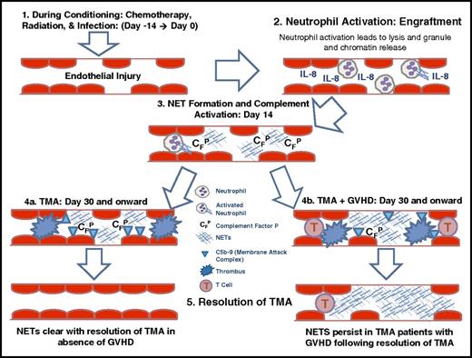 Figure 5. Proposed mechanistic link between endothelial injury, complement activation, and TA-TMA and GVHD. Based on our results, our proposed mechanism is as follows: 1. Chemotherapy, radiation, and infection lead to endothelial injury during early stages of HSCT. 2. Endothelial injury releases IL-8, causing neutrophil activation with release of NETs. 3. NET formation leads to complement activation with deposition of complement factor P and C5b-9 deposition. 4. Complement activation results in microthrombi formation. 5. Treatment with complement blockade leads to clearance of NETs and resolution of TA-TMA, but in patients with GVHD, NETs remain secondary to persistent endothelial injury. CFP, complement factor P.