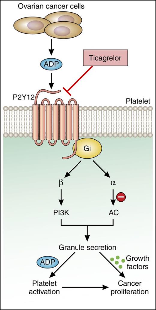 The central role of P2Y12 receptor in platelet-induced cancer cell proliferation. Cho et al demonstrate that platelet-induced proliferation and growth of ovarian cancer cells requires platelet activation mediated by ADP-P2Y12 signaling. The use of the P2Y12 antagonist ticagrelor may be a useful therapeutic approach to limit ovarian cancer growth. AC, adenylyl cyclase; Gi, inhibitory regulative G-protein; PI3K, phosphatidylinositol 3-kinase. Professional illustration by Patrick Lane, ScEYEnce Studios.