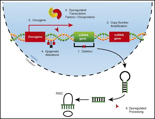 Figure 1. Mechanisms of dysregulated miRNA expression in AML. miRNA dysregulation can contribute to the development of AML. Thus far, numerous mechanisms by which miRNAs become dysregulated in AML have been identified, including (1) deletions leading to decreased miRNA expression, (2) improper expression because of close proximity to an oncogenic genomic region created as a result of either a translocation event or overexpression of a neighboring protein-coding gene, (3) copy number amplifications leading to increased miRNA expression, (4) epigenetic alterations affecting miRNA expression, (5) miRNA promoter regions being aberrantly targeted by dysregulated transcription factors or oncoproteins, and (6) dysregulated miRNA processing leading to altered levels of mature miRNAs.