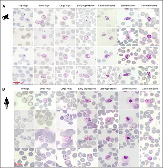 Figure 2. Erythrocytic development of P cynomolgi in monkey and human hosts. Giemsa-stained thin films of P cynomolgi in (A) monkey (M mulatta) normocytes and (B) human reticulocytes matured ex vivo over a period of 42 hours. The parasite was staged into the following categories: tiny ring (0-6 hours after invasion), small ring (6-12 hours after invasion), large rings (12-18 hours after invasion), early trophozoites (18-24 hours after invasion), late trophozoites (24-30 hours after invasion), early schizonts (30-36 hours after invasion), and mature schizonts (36-42 hours after invasion). Scale bar = 10 μm.