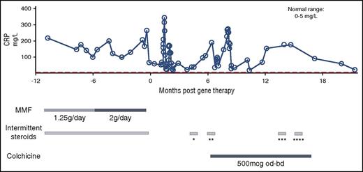 Figure 6. Clinical course pre- and post-GT showing a reduction in serum C-reactive protein over time. *Prednisolone 30 mg daily for 3 days; ankle swelling and cutaneous tenderness, vasculitis (?). **Prednisolone 30 mg daily for 4 days; admitted with lymphadenopathy, pyrexia of unknown origin. ***Prednisolone 30 mg daily for 3 days; foot swelling and cutaneous tenderness (self-medicated). ****Prednisolone 30 mg daily for 3 days; cutaneous tenderness and nodules (self-medicated). bd, twice daily; CRP, C-reactive protein; MMF, mycophenolate mofetil; od, once daily.