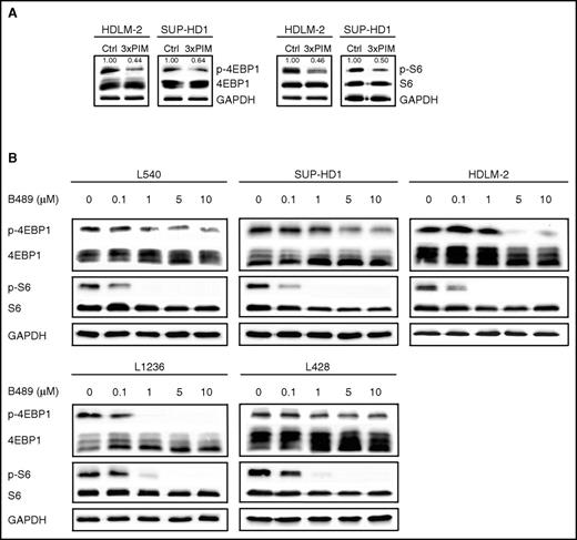 Figure 4. PIM inhibition blocks cap-dependent translation in RS cells. (A) PIM depletion decreases activity of 4E-BP1 and S6. Cells were transfected with a nontargeting siRNA (control, Ctrl) or with a siRNA cocktail targeting all 3 PIM kinases (3×PIM). After 4 days, p-4EBP1 (S65) and p-S6 (S235/236) protein expression was assessed by immunoblotting. GAPDH served as a loading control. Densitometric quantifications of band intensities (p-4EBP1 and p-S6, normalized to 4EBP1 and S6, respectively) are indicated above the lanes. (B) SEL24-B489 downregulates PIM-specific 4EBP1 and S6 phosphorylation. Cells were incubated for 4 hours with DMSO alone or with increasing doses (0.1-10 µM) of SEL24-B489, harvested, and lysed. Expression of p-4EBP1 (S65) and p-S6 (S235/236) were analyzed by immunoblotting. GAPDH served as a loading control. Densitometric quantifications of band intensities are shown in supplemental Table 6. Data in A-B are representative of 3 independent experiments.