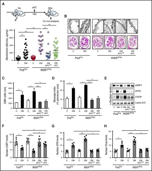 Figure 2. Activated PC rescues defective insulin signaling in DKD. (A-D) Schematic illustration of interventional studies in mice with STZ-induced hyperglycemia (A, top). Dot plot summarizing albuminuria (A, bottom); representative images and bar graph of the glomerular filtration barrier (B, upper panel; C, transmission electron microscopy; GBM, glomerular basement membrane, arrows; scale bar: 2 µm). Representative images and bar graph showing extracellular matrix deposition (B, lower panel; D, PAS staining; scale bar: 20 µm). (E-H) Representative immunoblots (E) and bar graphs (F-H) showing nuclear levels of ER transcription factors in renal cortex samples. C, control mice without diabetes; DM, diabetic mice. Mean ± SEM of at least 15 (A), 10 (C-D), or 6 (F-H) mice per group. *P < .05; **P < .01 (C-D, F-H: ANOVA).