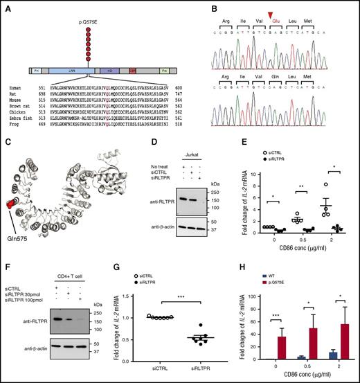 Figure 5. Identification of a novel recurrent, gain-of-function RLTPR mutation (p.Q575E) in CTCL. (A) Schematic of the recurrent RLTPR (p.Q575E) amino acid alteration. CBR, capping protein binding region; HD, helical domain; PH, pleckstrin homology; Pro, proline-rich region. (B) Confirmation of the RLTPR mutation by Sanger sequencing. Chromatogram of Sanger sequencing of genomic DNA from CTCL tumor cells (upper) and matched germline controls (ie, monocytes; lower). (C) Protein structure of the RLTPR homolog, CARMIL, showing the location of the p.Q575E amino acid alteration. CARMIL harbors 38% identity more than 670 amino acids when aligned to RLTPR, and p.Q575 is conserved between the 2 proteins. (PDB ID: 4K17).36 (D) Expression of RLTPR in Jurkat cells nucleofected with siCTRL or siRLTPR. Immunoblot analysis with RLTPR antibody, and β-actin as the loading control. (E) Downregulation of RLTPR inhibits TCR signaling in Jurkat cells. IL-2 mRNA expression in Jurkat cells nucleofected with siCTRL or siRLTPR in the presence of pharmacological TCR mimics (PMA/ionomycin) and a CD28 ligand, CD86. Data are shown as mean ± standard error from 4 independent biological replicates. P value was determined by 2-sided paired ratio t test (*P < .05; **P < .01). (F) Expression of RLTPR in isolated CD4+ T cells nucleofected with siCTRL or siRLTPR. (G) Downregulation of RLTPR inhibits TCR signaling in CD4+ T cells. IL-2 mRNA expression in CD4+ T cells nucleofected with siCTRL or siRTLPR in the presence of anti-CD3/anti-CD28 activation beads. Data are shown as mean ± standard error from 7 independent biological replicates from peripheral blood mononuclear cells of 2 different healthy donors. P value was determined by 2-sided paired ratio t test (***P < .001). (H) The RLTPR mutation significantly increases TCR signaling. Jurkat cells were transduced with RLTPR WT or RLTPR p.Q575E. These cells were treated with vehicle control or PMA (50 ng/mL)/ionomycin (300 ng/mL) and CD86 at the indicated concentrations. Data represent as mean ± standard error from 6 independent experiments. P value was determined by 2-sided paired ratio t test. *P < .05; ***P < .001.