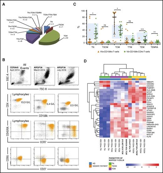Figure 1. Phenotypic heterogeneity of circulating CD158k+ T cells. (A) Among 47 patients, 28 display SCs of only 1 phenotype, mostly TCM, whereas 19 present a mix of several subsets, comprising naïve, TSCM, TCM, TTM, TEM, or TEMRA. (B) Example of 2 Sézary patients: CERA45, with 87% of SCs displaying a TSCM phenotype (CD45RA+CCR7+CD27+CD95+), stable over time; ARGP38, with SCs being exclusively naïve (85%) (CD45RA+CCR7+CD27+CD95−) in March 2014, presented a mix of naïve (66%) and TCM (30%) (CD45RA−CCR7+CD27+) in July 2016, along with an increase of blood tumoral burden and large-size lymphocytes (from 0.02 G/L CD158k+ T cells in November 2015 to 2.5 G/L in July 2016). (C) Vβ+CD158k+ T cells versus Vβ−CD158k−CD4+ T cells naïve/memory phenotype distribution within 17 patients. Ranges in 18 HDs are indicated by the blue backgrounds (mean ± 2 SD). Results were obtained after immunostaining on thawed PBMCs. Statistical analyses are paired among patients (Wilcoxon test), and a Mann-Whitney test was used for comparisons with HDs. Results are expressed as medians ± interquartile ranges. (D) Heat map resulting from supervised hierarchical clustering of differentially expressed genes among the TN, TSCM, and TCM phenotypes of CD4+ T cells from HDs and CD158k+CD4+ T cells from Sézary patients (P = .00001 | log2 fold change | > 1). ns, not statistically significant. *P < .05. **P < .01. ***P < .001.