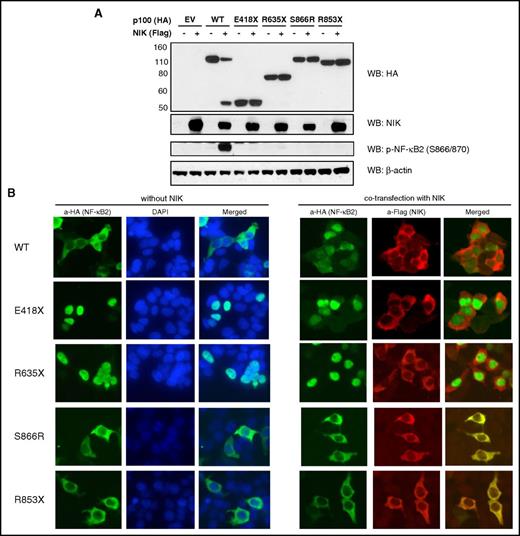 Figure 3. Protein expression and localization of mutant NF-κB2 in transfected cells. (A) HEK293T cells were transiently transfected with the indicated constructs in the presence and absence of NIK coexpression. Cell lysates were analyzed for phosphorylation of p100 and for p100, p52, and mutant expression by western blotting. E418X mutant size was closed to the active form p52. All other mutants are failed phosphorylation and processing to p52 in the presence of NIK expression. Molecular weight markers are indicated on the left size (kilodaltons). (B) HEK293T cells were transiently transfected indicated WT or mutant vector (pcDNA3-HA) with or without Flag-NIK. Nucleus was labeled with DAPI (blue). Original magnification ×175. Cells were stained with anti-Flag and anti-HA antibody, followed by Alexa 488-conjugated (for HA-NF-kB2, green) and Alexa 568-conjugated (for Flag-NIK, red) secondary antibody. Data shown are representative of 3 experiments.