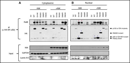 Figure 4. Increased interaction of RelB with mutant E418X, R635X in nuclear fraction. HEK293T cells were transiently transfected with the indicated constructs in the presence and absence of NIK coexpression. (A) Cytoplasmic and (B) nuclear fractions were prepared, and immunoprecipitated with an α-HA antibody. Cell lysates from IP samples were analyzed for the interaction of NF-κB2 (WT or mutants) with RelB. The faint band at 50 kDa in all lanes is immunoglobulin heavy chain. Immunoblotting of Lamin A/C and GAPDH was used as a marker for the nuclear and cytoplasmic fraction, respectively. Red asterisks indicate increased interaction of mutant E418X, R635X with RelB without NIK expression. Blue asterisks indicate increased translocation of mutant forms E418X, R635X, and active form of NF-κB2 (p52) to the nucleus. Data shown are representative of 3 experiments.