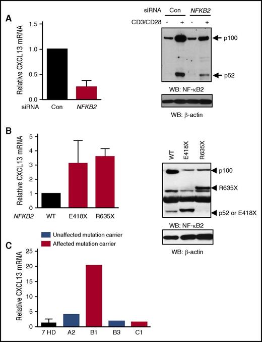 Figure 5. Regulation of CXCL13 gene expression by NF-κB2 protein. (A-B) Indicated siRNA or pcDNA3-HA-NFKB2 (WT or mutants) were transfected into total PBMCs from healthy donor control. Next day, cells were washed and stimulated with Dynabeads-CD3/28 for 48 hours. RNA was prepared and CXCL13 gene expression was analyzed by real-time PCR. A fold change was calculated for NFKB2 siRNA or mutants with control vector (A) or WT (B) transfected cells, normalize to 1. CXCL13 was not detected in unstimulated samples. Decreased NF-κB2 (A) or overexpressed WT or mutant protein expression (B) was confirmed by western blot. Results shown are means + standard error of the mean of 3 independent experiments. (C) CD4 T cells were enriched using stem cell negative selection kit and cells were stimulated with Dynabeads-CD3/28 for 48 hours. Levels of CXCL13 mRNA in activated CD4 T cells from indicated patients were measured by real-time PCR using the probe for CXCL13 and normalized to 18S rRNA. CXCL13 expression was not detected in A1 due to low cell number. Data are means value of replicates from indicated patients. For relative gene expression, all data were normalized to the paired normal control.