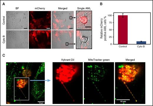Figure 3. Mitochondria transfer to leukemic blasts occurs via TNT. (A) BMSC were transduced with a rLV.EF1. mCherry-Mito-9 Lentivirus. AML blasts were cultured on mCherry-Mito-9 positive BMSC and were analyzed by live cell imaging. With and without cytochalasin B. (Scale bar, 10 µm.) (B) Multiple primary AML blasts were cultured on rLV.EF1. mCherry-Mito-9 Lentivirus transduced BMSC with and without cytochalasin B; the percentage of mCherry positive AML is shown. (C) AML blasts were stained with Vybrant Dil for 1 hour and washed 3 times in PBS. BMSC were stained with MitoTracker green FM for 1 hour and washed 3 times in PBS. AML blasts and BMSC were then cocultured for 24 hours before fixation, using paraformaldehyde. Cells were visualized by confocal microscopy.
