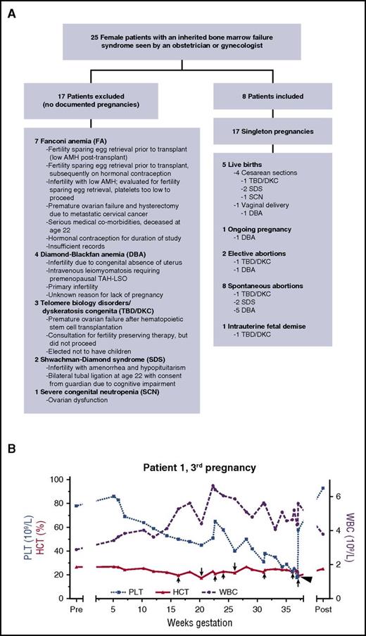 Figure 1. Study schematic and blood count trends in 1 successful pregnancy. (A) Schematic of evaluable patients. (B) Blood count parameters during the third pregnancy of Patient 1, who had short telomeres and a heterozygous TERC mutation (TBD/DKC). Red blood cell transfusions are indicated by arrows, with longer arrows representing 2 units transfused and shorter arrows representing 1 unit transfused. A single platelet transfusion is represented by an arrowhead. HCT, hematocrit; PLT, platelet count; Post, 4 months postpartum; Pre, 2 weeks before predicted conception; WBC, white blood cell count.