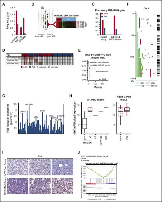 Figure 4. MIR17HG and Chr8q are gained in mBL. (A) Frequency of DNA CN gains found in adult (red-orange) or pediatric (blue) mBL for MIR17HG and paralogues MIR106B and MIR106A. (B) Heat maps of expression of the MIR17∼92 cluster members measured by TaqMan Array Human MicoRNA A Card (ABI) in tumors with and without MIR17HG DNA copy number gain. (C) Validation of the frequency of MIR17HG DNA CN gain in adult-BL using a published BL genomic/WES dataset. CN status was assessed using Varscan2 CNV followed by segmentation by the Circular binary segmentation algorithm. For WES data, regions of gain were cut off at a threshold of 0.2 log2 ratio. (D) Copy number status of MIR17HG and paralogues for individual tumors (gain = red, loss = green). (E) Kaplan-Meier curves comparing overall survival adult-mBL cases by MIR17HG copy number status. Several MIR17HG gain/amplified cases also had double MYC/ BCL2 translocation/mutation, but showed BL mutation and GEP profile. (F) Plot of CNAs along chromosome 8 for mBL cases with abnormalities. (G) Bar graph of the fold increase in expression of genes along chromosome 8 that are significantly upregulated (P < .05, 1-sided Student t test) in cases with CN gain. Genes of interest are noted. (H) Boxplot of MYC mRNA expression by MYC DNA copy number status and by age. Red points represent expression values of individual cases. Expression levels in normal centroblasts (CB), CD77-negative cells, and naive B cells (NBC) are noted for comparison. (I) MYC protein expression in 3 cases with MYC gain and 3 cases with a MYC DNA copy number=2. (J) Signatures upregulated on MYC overexpression were enriched in pediatric-mBLs compared with adult-mBLs.