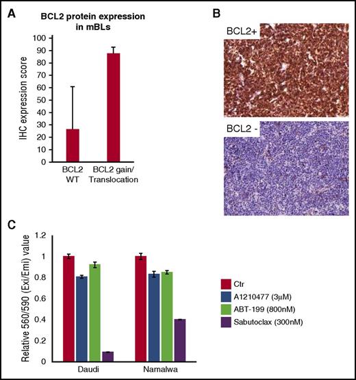 Figure 5. 18q21 gain or BCL2 translocation is associated with BCL2 protein expression. (A) BCL2 IHC was performed and scored on adult-mBL cases with no evidence of BCL2 gain/translocation based on clinical data, NGS, and SNP array (n = 7) and cases with BCL2 gain/translocation (n = 6). Bars represent the mean expression score and error bars represent 1 standard deviation. (B) Example of BCL2-positive and BCL2-negative staining cases (original magnification, ×20). (C) BL cell lines are sensitive to a pan-BCL2 inhibitor compared with single-agent inhibitors. Bars represent the mean of 3 replicates from 1 representative experiment of at least 3 separate experiments, and error bars represent 1 standard deviation.