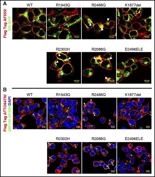 Figure 6. Cellular localization of wild-type and mutant PIEZO1 determined by IF confocal microscopy. (A) Wild-type and mutant FLAG-tagged PIEZO1-expressing HEK293 cells were transfected with ER-GFP, a plasmid that expresses GFP fused to the ER signal sequence of calreticulin and KDEL (ER retention signal). Cells were stained with anti-FLAG AF555 (red) and anti-GFP (green). (B) Wild-type and mutant FLAG-tagged PIEZO1-expressing HEK293 cells were stained with anti-FLAG ATT0647N (red), DAPI (blue), and an antibody against Golgi apparatus, anti-GM130, conjugated with Alexa Fluor 488 (green). Three arginine mutants, R2488Q, R2302H, and R2088G, demonstrated partial intracellular retention, colocalizing with ER and Golgi markers. Scale bars, 10 μm.