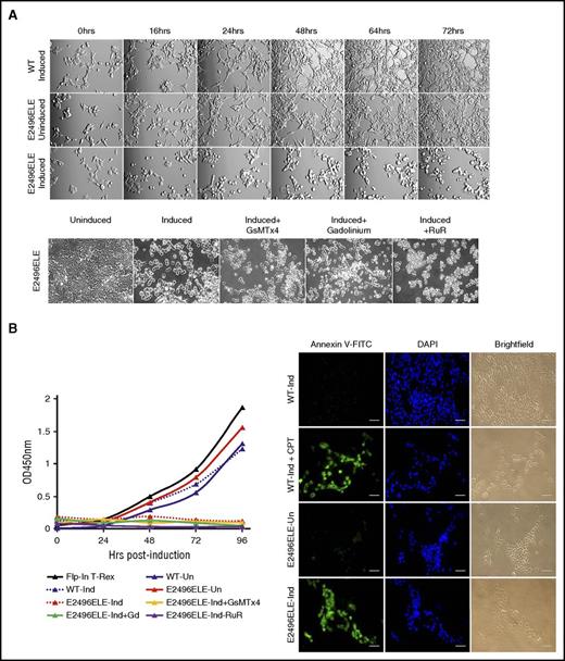 Figure 7. Studies of the E2496ELE PIEZO1 mutant. (A) HEK293 cells expressing the E2496ELE mutant displayed morphological changes upon induction. Top panels: compared with wild type, the mutant cells demonstrated swelling as early as 16 hours postinduction with rounding up of edges, followed by wide-scale detachment of cells from the plate by 48 hours. Bottom panels: none of the known PIEZO1 inhibitors, including the G spatulata mechanotoxin (GsMTx4), gadolinium, or ruthenium red, protected cells from this effect. Original magnification ×100. (B) Live cell numbers and annexin V staining. Beginning at ∼48 hours postinduction, the number of live, mutant cell numbers determined by CCK8 staining decreased dramatically (left graph) and cells began to undergo apoptosis as assayed by annexin V staining (right). Camptothecin (CPT) was used for artificial induction of apoptosis in wild-type cells. Scale bars, 1 μm. FITC, fluorescein isothiocyanate.