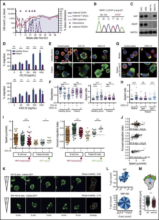Figure 1. Identification of a WIP-deficient patient and of the role of WIP in lymphocyte chemotaxis. (A) Immune reconstitution and plasma CMV load in the patient after sequential infusion of peripheral blood lymphocytes and stem cells from the HLA-identical mother (sequential DLI/HSCT). Doses were calculated for a target number of T cells (from 1 × 106/kg CD3+ to maximum 1 × 107/kg CD3+ cells; white triangles) and stem cells (2 × 107/kg CD34+ plus 2 × 107/kg CD3+ cells; black triangles). Plasma concentration of CMV nucleic acid is shown as copies per milliliter (dotted line, left y-axis). Chimerism of maternal CD3+ T cells is plotted as absolute number (solid line, left y-axis) and proportion (gray-shaded area, right y-axis). (B) Electropherogram of Sanger sequencing depicting the homozygous c.373C>T mutation in WIPF1. (C) Western blot analysis of WIP and WASP in EBV–immortalized B cell lysates from 2 healthy donors, the WIP patient and a Wiskott-Aldrich syndrome (WAS) patient. Data were confirmed in 3 independent experiments. (D) Transwell migration of expanded T cells in response to the indicated concentrations of CCL19 and CXCL12. Histograms correspond to the mean ± standard deviation of triplicate values of 1 representative experiment out of 3. (E) Representative pictures of expanded T cells from the patient and a control, following stimulation with CCL19 or CXCL12 and staining for WIP and F-actin. (F) Roundness and aspect ratio values were extracted with ImageJ analysis from 45 to 106 cells per condition. (G) Representative pictures of T cells recovered post-DLI/HSCT, stimulated with CCL19 or CXCL12 and stained for WIP and F-actin. (H) Roundness and aspect ratio values were extracted with ImageJ analysis from 42 to 72 cells per condition. (I) Speed and forward migration index were extracted from the trajectory records of the indicated cells using the Ibidi chemotaxis tool. Data represent 1 representative experiment out of 3. (J) Plots showing correlation between cell speed and forward migration index along the y-axis (chemokine gradient) for the indicated cells. Data represent 1 representative experiment out of 3 performed. (K) Time-lapse video recording of the LifeAct-GFP expressing wt or WIP-KD B cells exposed to a CCL19 gradient, with color plot showing time evolution of cell contour. The volatility values pertain to the representative cells shown in the time-lapse series. (L) Plots representing the cell polarization angle frequency. The CCL19 source is on top. The orientation of the major cell axis was calculated for 400 cell snapshots per condition. (M) Values of actin polarization vector, calculated as the distance between cell and actin centers of mass. The length of the vector was projected along the y-axis to combine actin polarization with cell orientation along the chemokine gradient. Data stem from 400 cell snapshots per condition. DLI, donor lymphocyte infusion; ns, not significant. Pt, patient. *P < .05, **P < .01, ***P < .001.