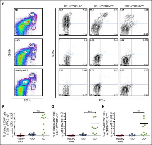 Increased CD11b fraction and circulating CD207+CD1a+myeloid cells in peripheral blood of patients with active LCH. (A) Gating strategy used to discriminate CD11b myeloid lineage and the CD4 T-cell compartment. (B-D) Independent data showing percentage of CD11bhighCD4low; CD11blowCD4neg, and CD11bhigh plus CD11blow cells in patients with AD (N = 9) compared with patients with NAD (N = 11) and healthy adults (N = 12). Unpaired 2-tailed t test was performed to compare AD patients with NAD patients or healthy adults. *P < .05; ***P < .001. (E) Representative dot plot and gating strategies used to discriminate CD11b and CD11c subpopulations from PBMCs. The expression of CD207 and CD1a was analyzed in CD11bhighCD11c+ monocytes, CD11blowCD11chigh DCs, and CD11blowCD11clow cells. (F-H) Independent data for positive CD207 cells, including CD207+ plus CD207+CD1a+ (Q1+Q2), for each gated subpopulation in AD patients (N = 9), NAD patients (N = 10), and healthy adults (N = 9) are shown. A 2-tailed Mann-Whitney test was performed (**P < .01; ***P < .001).