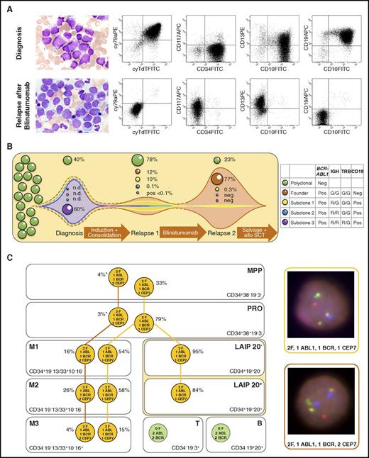 Figure 1. Leukemic involvement and evolution of BCR-ABL1–positive blasts in patient 21. (A) Blast morphology and flow cytometric dot plots of blasts before blinatumomab (first row) and blasts after blinatumomab (second row). Cytomorphology images were acquired using a 63×/1.40 numeric aperture oil objective in a Zeiss Axioplan 2 microscope (Zeiss, Jena, Germany) after Pappenheim's staining (panoptic staining). Blasts at initial diagnosis were positive for CD19, CD10, cyCD79a, CD34, TdT, cyCD22*, HLA-DR*, and cyIgM*; showed aberrant expression of CD13; and were negative for CD117, CD33*, and MPO*. The expression profile did not fulfill World Health Organization criteria for classification as mixed-phenotype leukemia. At relapse after blinatumomab therapy, blasts were negative for CD19, CD10, cyCD79a, CD34, TdT, HLA-DR*, and MPO* and expressed myeloid antigens CD117, CD13, and CD33* (* indicates respective antigen expression not shown in the dot blots). (B) Hypothetical model of clonal evolution and selection of different subclones based on BCR-ABL1 and immunoglobulin heavy chain (IGH) and T-cell receptor β (TRB) gene rearrangement patterns (figure not to scale). Patients with leukemia were screened at initial diagnosis for clonal IG and TR gene rearrangements. Two clonal IGH gene rearrangements (VH3-23-DH2-2-JH6 and VH6-1-DH3-22-JH4) and 1 clonal cross-lineage TRB gene rearrangement (DB2-JB2.7) were detected, and clone-specific real-time quantitative polymerase chain reaction (RT-qPCR) assays were established on the basis of sequence information. RT-qPCR and BCR-ABL1 FISH showed dominance of the IGH R/R, TRB R/G, and BCR-ABL1–rearranged clone (R, rearranged; G, germ line). At first relapse, the IGH R/G TRB G/G clone was dominant, but the second IGH rearrangement was detected at a level of only 0.1% and TRB only at a level below the quantitative range of 0.1%. At second relapse, the leukemic bulk did not show an IG/TR gene rearrangement, but only the BCR-ABL1 translocation RT-qPCR revealed a subclonal IGH gene rearrangement (0.3%). A clonal evolution of the leukemic bulk with occurrence of a new dominant IGH/TRB gene rearrangement was excluded by IGH/TRB multiplex PCR, which has a sensitivity of about 1% to 5%. (C) Subclonal architecture of BCR-ABL1 fusion and monosomy 7 in immunophenotypic compartments of patient 21 at initial diagnosis analyzed by FISH after FACS. Left: FISH results of each compartment. Orange circle, aberrant signal constellation; green circle, normal signal constellation; asterisk (*) indicates being within the range of the FISH and sorting purity cutoff. Right: Representative interphase nuclei showing the 2 different aberrant signal constellations in a false color display using MetaSystems software. FISH images were acquired using a 63×/1.40 numeric aperture oil objective in a Zeiss Axioskop 2 fluorescence microscope (Axioskop 2). The meaning of signals is as follows: isolated red, ABL1; isolated green, BCR; red-green fusion signal, BCR-ABL1 fusion; blue, centromere 7. APC, allophycocyanin; B, mature B cells; CEP7, centromere 7 signal; F, BCR-ABL1 fusion signal; FITC, fluorescein isothiocyanate; leukemia-associated immunophenotype 20− (LAIP 20−), leukemic bulk without CD20 coexpression; LAIP 20+, leukemic bulk with CD20 coexpression; M1, early myeloid compartment; M2, late myeloid compartment; M3, mature myeloid compartment; MPP, multipotent progenitor cells; n.d., not determined; neg., negative (not detected); PE, phycoerythrin; pos, positive; PRO, myeloid and lymphoid progenitors; SCT, stem cell transplantation; T, mature T cells.